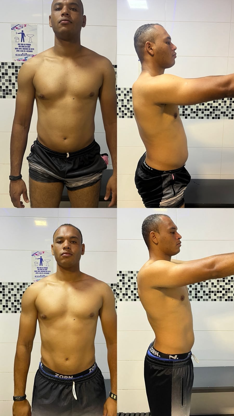 Aluno de frente e de perfil, antes e depois do acompanhamento